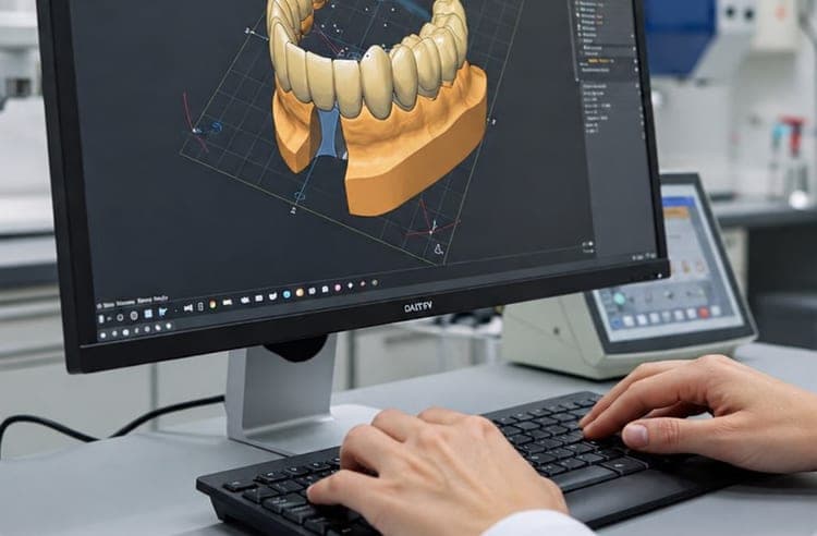 Technician designing a dental restoration in CAD software
